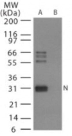 Avian Influenza A H6N1 Nucleoprotein Antibody, Novus Biologicals 0.1mg;