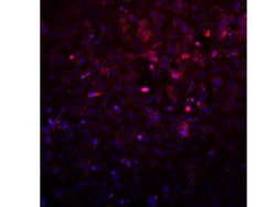 AVL9 Antibody, Novus Biologicals 0.1mL; Unlabeled:Antibodies, Polyclonal