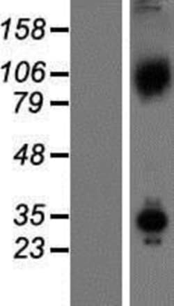 Novus Biologicals™ Axin-1 Overexpression Lysate