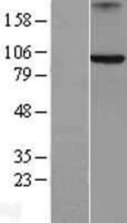Novus Biologicals™ Axin-2 Overexpression Lysate