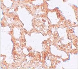 Axin-2 Antibody - BSA Free, Novus Biologicals 0.1mg; Unlabeled:Antibodies,