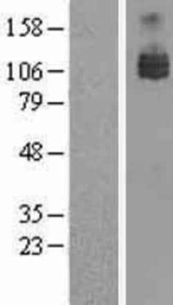 Novus Biologicals&trade;&nbsp;Axl Overexpression Lysate