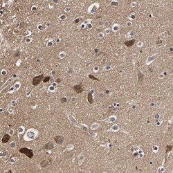 Axotrophin Antibody, Novus Biologicals 25 &mu;L | Buy Online | Novus Biologicals | Fisher Scientific