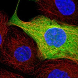 AZI2 Antibody, Novus Biologicals 0.1mL; Unlabeled:Antibodies, Polyclonal