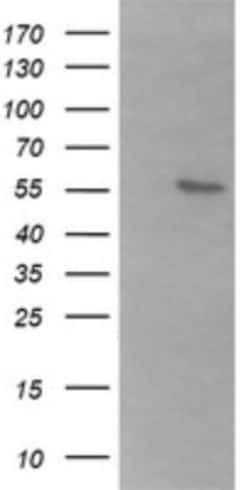 B3GALNT2 Antibody (OTI1G2), Novus Biologicals 0.1mL; Unlabeled:Antibodies,