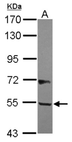 B3GALNT2 Antibody, Novus Biologicals 0.1mL; Unlabeled:Antibodies, Polyclonal