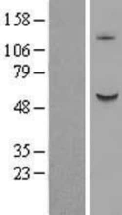 Novus Biologicals™ B3GALNT2 Overexpression Lysate
