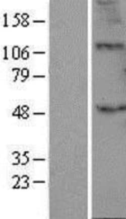 Novus Biologicals™ B3GALT2 Overexpression Lysate