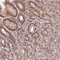 B3GALT5 Antibody, Novus Biologicals:Antibodies:Primary Antibodies