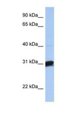 B3GALT6 Antibody, Novus Biologicals 0.05mg; Unlabeled:Antibodies, Polyclonal