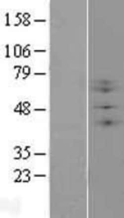 Novus Biologicals™ Beta-1,3-N-Acetylglucosaminyltransferase 2/B3GNT2 Overexpression Lysate