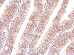 B3GNT3 Antibody, Novus Biologicals 0.1mg; Unlabeled:Antibodies, Polyclonal