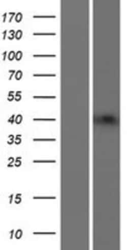 Novus Biologicals™ Beta-1,3-N-Acetylglucosaminyltransferase 4/B3GNT4 Overexpression Lysate
