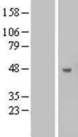 Novus Biologicals&trade;&nbsp;B3GNT5 Overexpression Lysate