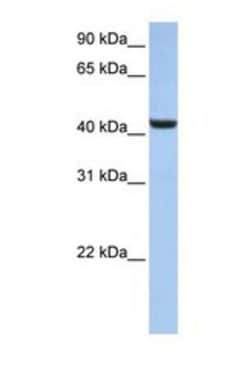 B3GNT7 Antibody, Novus Biologicals 100 &mu;L | Buy Online | Novus Biologicals | Fisher Scientific