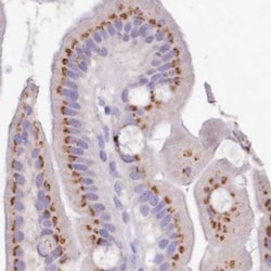 B3GNT8 Antibody, Novus Biologicals 0.1mL; Unlabeled:Antibodies, Polyclonal