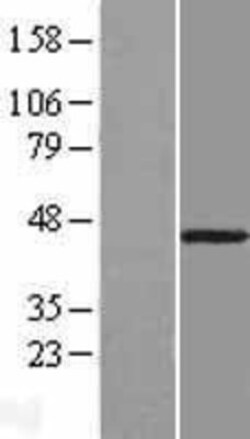 Novus Biologicals&trade;&nbsp;B3GNT9 Overexpression Lysate