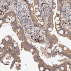 B3GNTL1 Antibody, Novus Biologicals 0.1mL; Unlabeled:Antibodies, Polyclonal