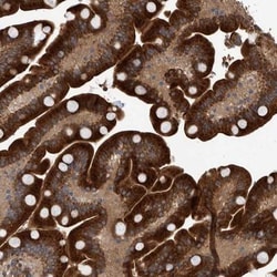 B3GNTL1 Antibody, Novus Biologicals:Antibodies:Primary Antibodies