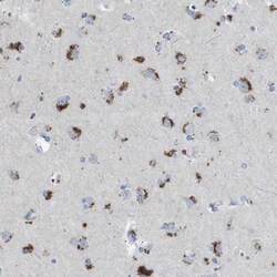 B4GALNT1 Antibody, Novus Biologicals 0.1mL; Unlabeled:Antibodies, Polyclonal