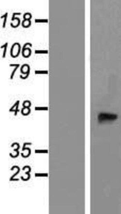 Novus Biologicals&trade;&nbsp;beta-1,4-Galactosyltransferase 2/B4GalT2 Overexpression Lysate