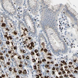 B4GALT3 Antibody, Novus Biologicals:Antibodies:Primary Antibodies