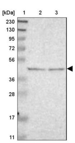 B4GALT3 Antibody, Novus Biologicals:Antibodies:Primary Antibodies