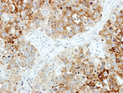 B4GALT4 Antibody, Novus Biologicals 0.1mL; Unlabeled:Antibodies, Polyclonal
