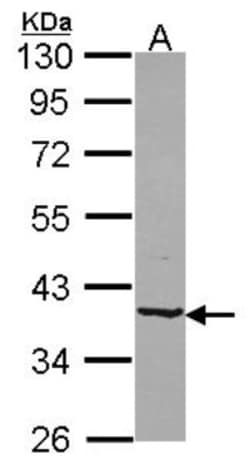 B4GALT4 Antibody, Novus Biologicals 0.1mL; Unlabeled:Antibodies, Polyclonal