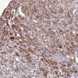 B4GALT6 Antibody, Novus Biologicals:Antibodies:Primary Antibodies
