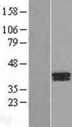 Novus Biologicals™ B4GALT7 Overexpression Lysate