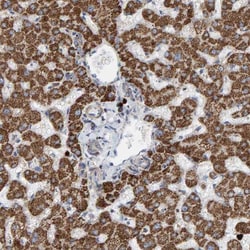 B9D1 Antibody, Novus Biologicals 25 &mu;L; Unlabeled:Antibodies, Polyclonal