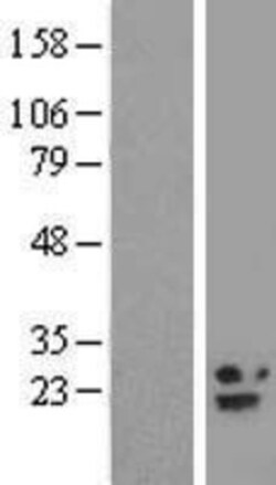 Novus Biologicals™ B9D2 Overexpression Lysate