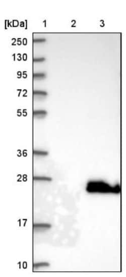 BAALC Antibody, Novus Biologicals 0.1mL; Unlabeled:Antibodies, Polyclonal