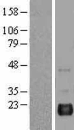 Novus Biologicals&trade;&nbsp;BAALC Overexpression Lysate