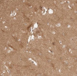 BAALC Antibody, Novus Biologicals 0.1mL; Unlabeled:Antibodies, Polyclonal