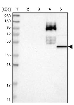 BAAT Antibody, Novus Biologicals 25 &mu;L, Unlabeled:Antibodies, Polyclonal