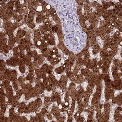 BAAT Antibody, Novus Biologicals 25 &mu;L, Unlabeled:Antibodies, Polyclonal