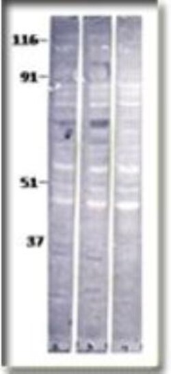 Baboon Antibody, Novus Biologicals 0.1 mg; Unconjugated:Antibodies, Polyclonal