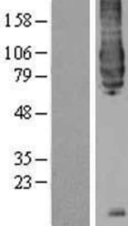 Novus Biologicals BACE-1 Overexpression Lysate 0.1 mg | Buy Online | Novus Biologicals&trade; | Fisher Scientific