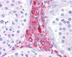 BACE-1 Antibody, Novus Biologicals 0.05mg; Unlabeled:Antibodies, Polyclonal