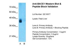 BACE-1 Antibody, Novus Biologicals 0.05mg; Unlabeled:Antibodies, Polyclonal
