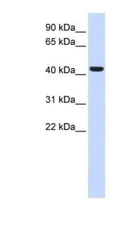 BACE-1 Antibody, Novus Biologicals 0.05mg; Unlabeled:Antibodies, Polyclonal