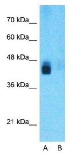 BACE-1 Antibody, Novus Biologicals 0.05mg; Unlabeled:Antibodies, Polyclonal