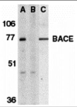 BACE-1 Antibody, Novus Biologicals 0.025 mg, Unconjugated:Antibodies, Polyclonal