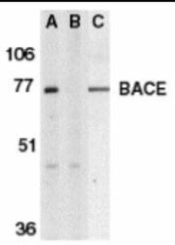 Novus Biologicals™ BACE-1 Antibody Blocking Peptide