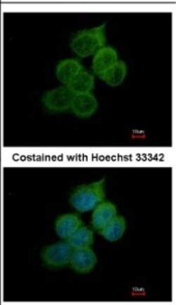 BACE-2 Antibody, Novus Biologicals 0.1mL; Unlabeled:Antibodies, Polyclonal