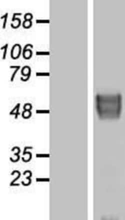 Novus Biologicals&trade;&nbsp;BACE-2 Overexpression Lysate