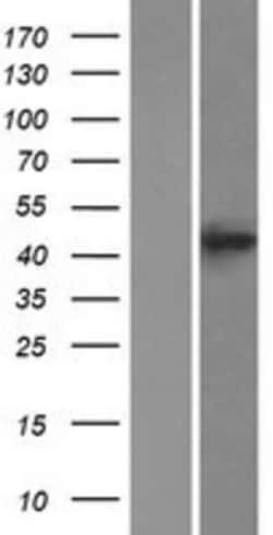 Novus Biologicals&trade;&nbsp;BACE-2 Overexpression Lysate