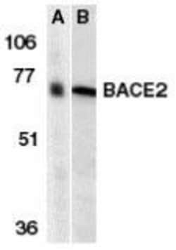 BACE-2 Antibody - BSA Free, Novus Biologicals 0.025 mg, Unconjugated:Antibodies,
